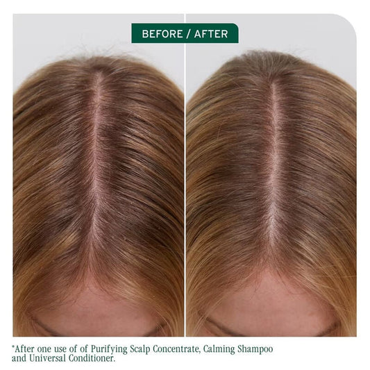 Biolage Scalp Sync Purifying Scalp Concentrate
